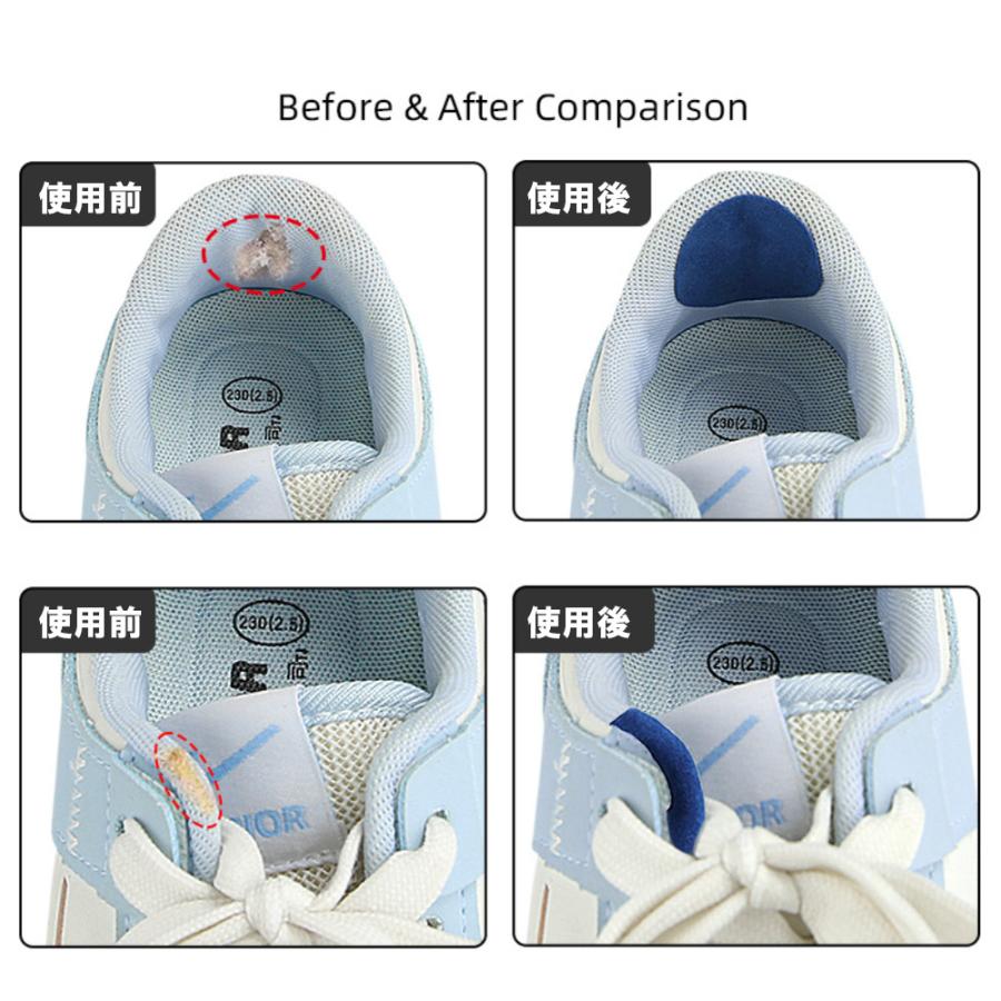 靴 かかと 補修 踵 補修 内側 スニーカー かかと内側補修 かかと修理 パッチ 靴かかと修理キット かかと破れ補修 シューズ 内側かかと補強 |  | 01