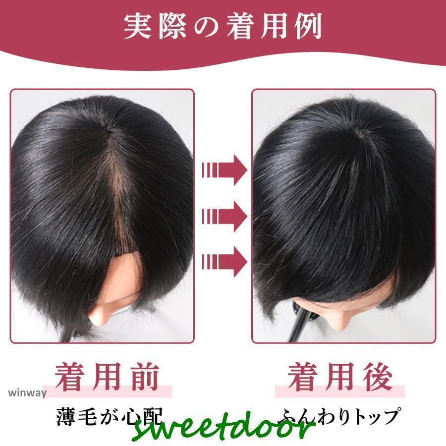 頭頂部ウィッグ 白髪隠し 頭頂部 ウィッグ 15cm 20cm 頭頂部 頭頂部ウィッグ 白髪隠し 頭頂部 ウィッグ 15cm 20cm 頭頂部