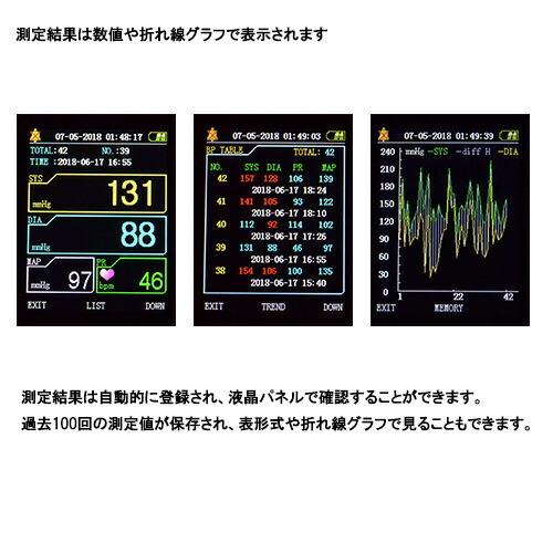 エルデ エルデ ペット用血圧計/PES-1700 : DCMオンライン - 通販 エルデ エルデ ペット用血圧計/PES-1700 : DCMオンライン - 通販