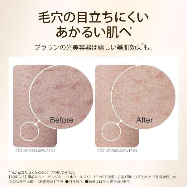 シルクエキスパート BRAUN ブラウン 家庭用光美容器 Pro5 IPL方式/VIO