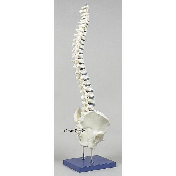せき椎骨分離屈伸模型 人体模型 腰椎模型⁄ヘルニア⁄分離症・すべり症