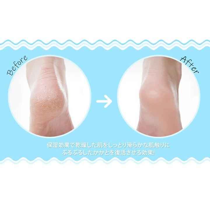 かかとケアサポーター 3足セット かかと靴下 角質ケア つるつる