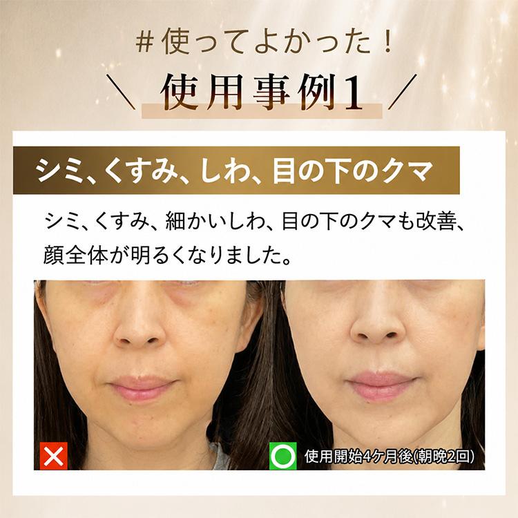 公式！＼最大7,980円お得／4,000円OFF+ギフト】DENSHINDO プラズマ