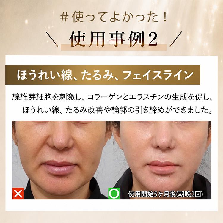 公式！＼最大7,980円お得／4,000円OFF+ギフト】DENSHINDO プラズマ