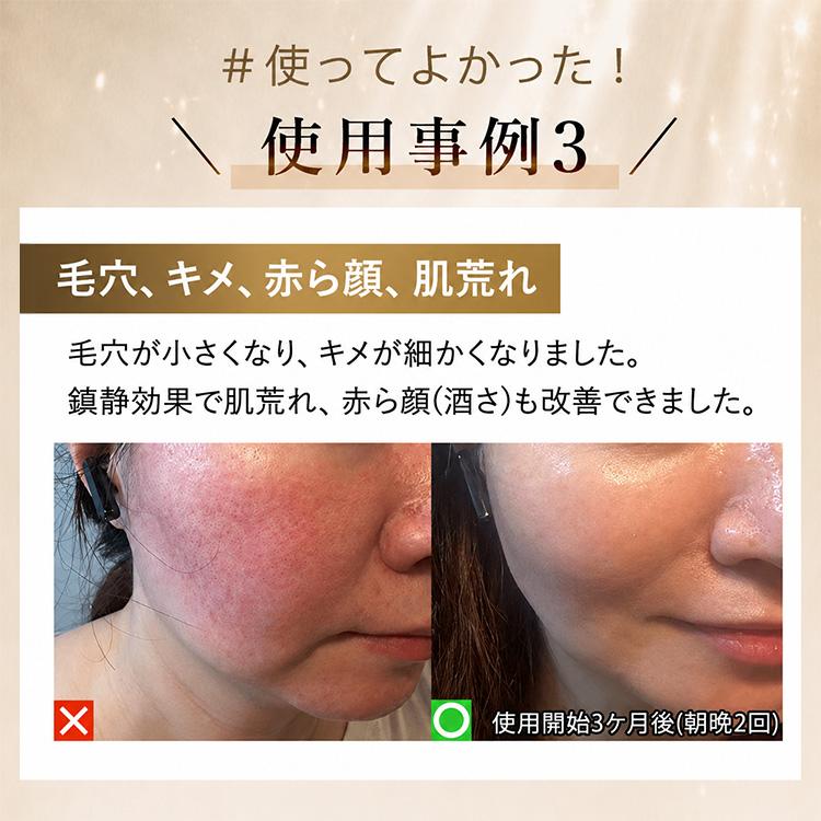 公式！＼最大7,980円お得／4,000円OFF+ギフト】DENSHINDO プラズマ