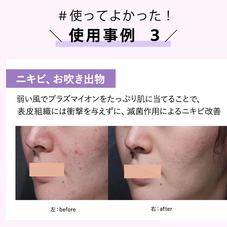 公式！月末SALE ポイント10倍】DENSHINDO プラズマ エアシャワー