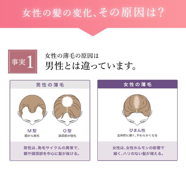 育毛剤 女性用 薬用 ヘアエッセンス 薄毛 抜け毛 増毛 デルメッド 120mL｜dermed｜05