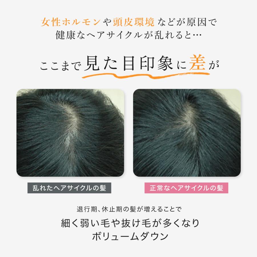 DERMED（デルメッド） 【デルメッド公式】【セット特価】ヘア