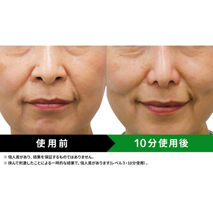 LUXCEAR（ルクセア） ルクセアフォーネスPRO（鼻用美顔器）/LUXCEAR
