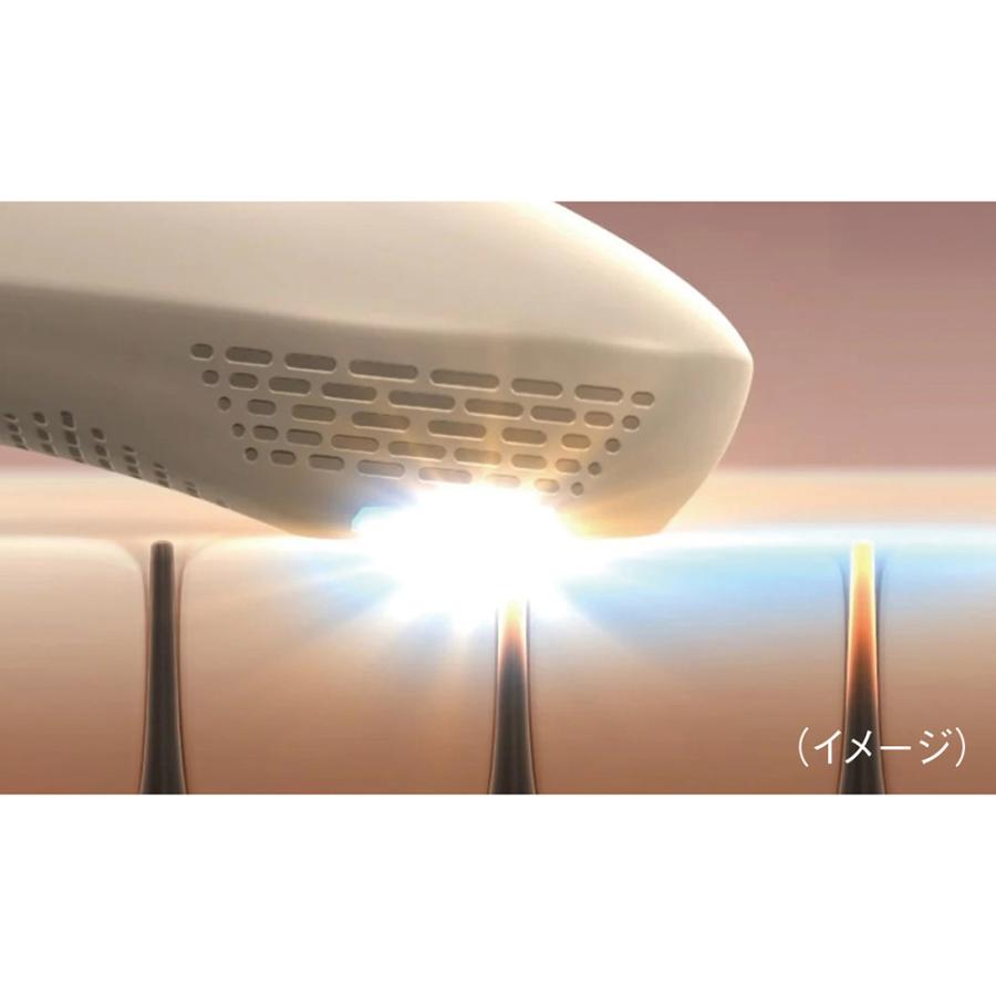 dinos（ディノス） STELLA BEAUTE/ステラボーテ IPL光美容器 Luna