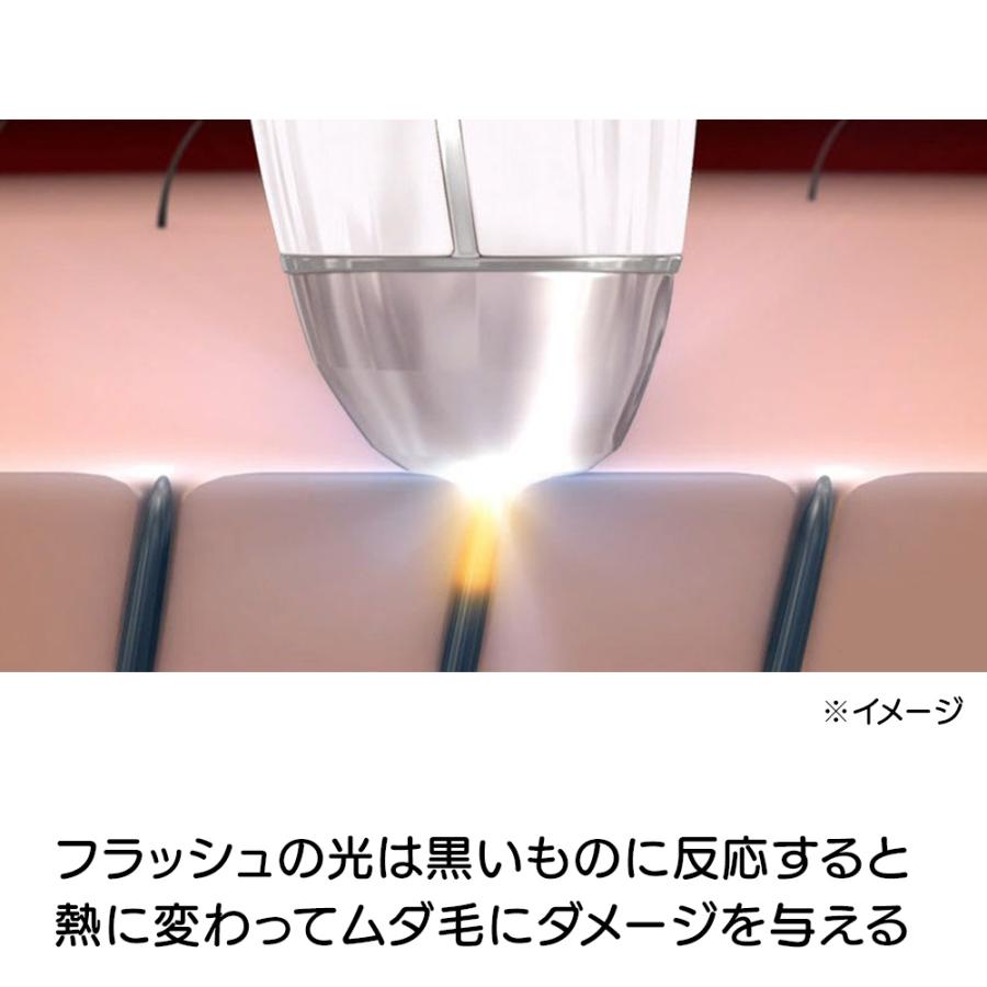 テレビ放送商品 美容 ダブルエピ ルミナスボーテ AR1992 : ar1992  