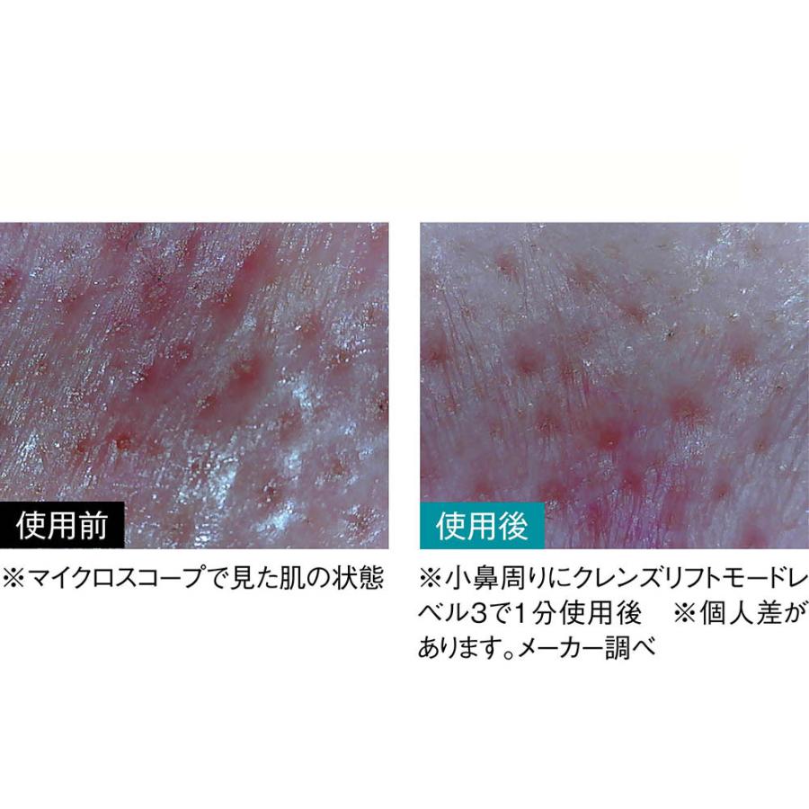 dinos 美顔器 EMS 顔 リフトアップ効果 フェイス 引き締め 毛穴