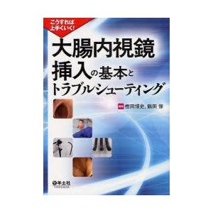 大腸内視鏡挿入の基本とトラブルシューティング こうすれば上手くいく!