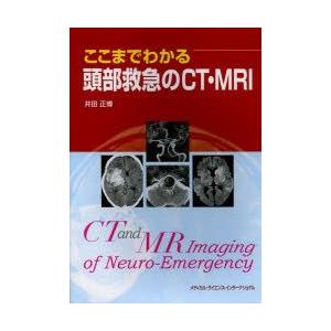 SNSで話題 MHDL4R8FWOG 型番:MHDL4R8FWOG
