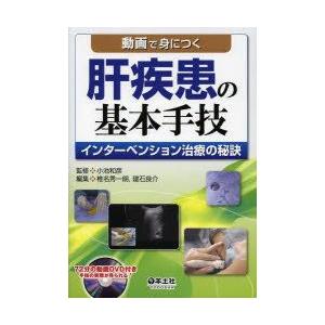動画で身につく肝疾患の基本手技―インターベンション治療の秘訣 羊土社