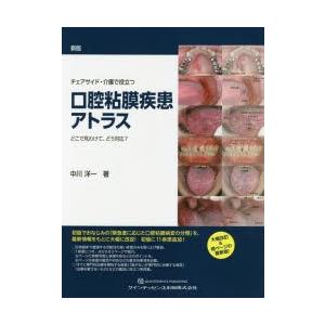 女性議長側面・介護で役立つ口粘膜病み煩いアトラス どこで見わけて、どう相応う? 中川洋一/著