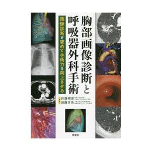 胸部画像診断と呼吸器外科手術 画像診断を究めて手術力を