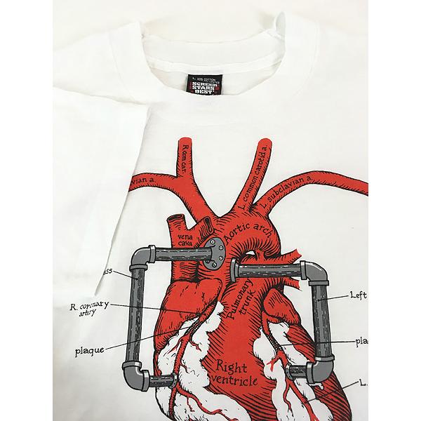 古着 80s USA製 心臓 医学 手術 バイパス 臓器 ポップ アート Tシャツ
