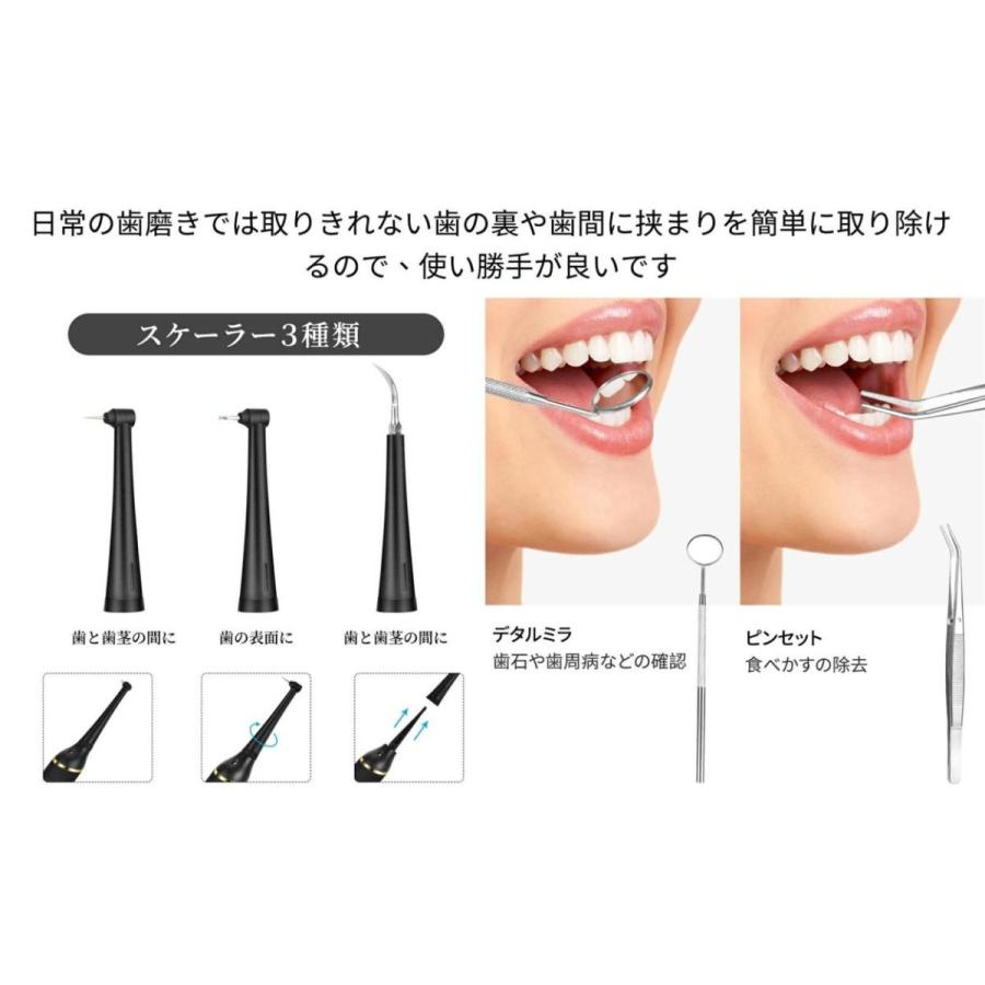 一年間保証 Ipx6防水 充電式 口腔洗浄器 器具 歯クリーナー 歯用ツール 歯石取り 歯石歯垢とり 自分で 超音波 超音波スケーラー 電動 電動歯ブラシ 今月限定 特別大特価 歯石取り
