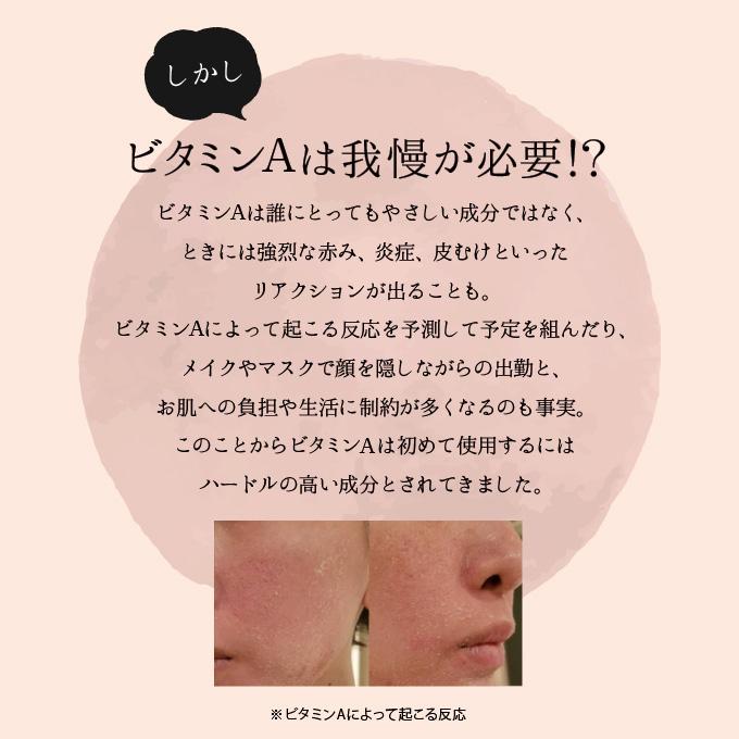 Lov me Touch（ラブミータッチ） グラナクティブレチノイド 7% ミルク