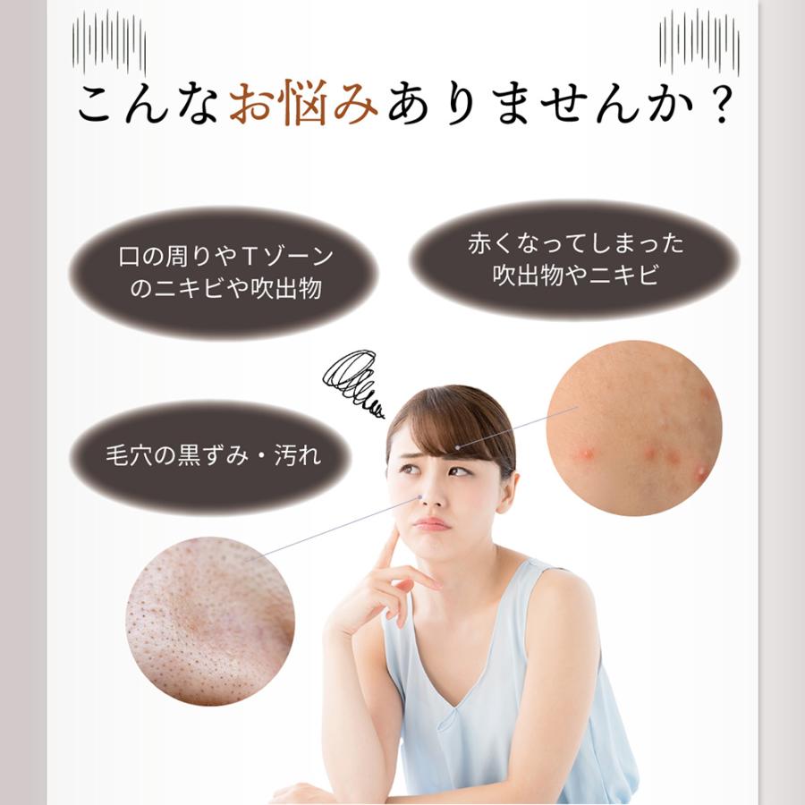 クリアズム プラズマ導入美顔器 毛穴 にきび 吹き出物 肌荒れ クリアズム プラズマ導入美顔器 毛穴 にきび 吹き出物 肌荒れ