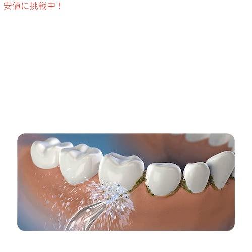並行輸入品】Waterpik ウォーターピック社 ウォーターフロッサー 歯垢