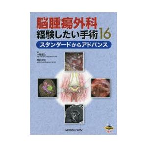 脳腫瘍外科経験したい手術16 スタンダードからアドバンス｜dss