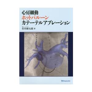 心房細動ホットバルーンカテーテルアブレーション | 