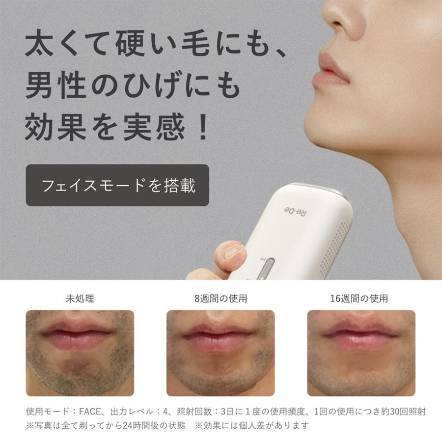 Re・De DuoClear IPL 光美容器 脱毛器 フラッシュ式脱毛器 リデ 家庭用 メンズ VIO ヒゲ 脱毛 美顔器 VIO対応 冷却機能 レディース BR01Aの画像