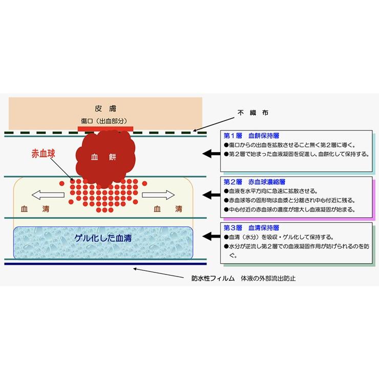 300個セット】 (メーカー直送) 医療用不織布 緊急用止血パッド 300個セット】 (メーカー直送) 医療用不織布 緊急用止血パッド