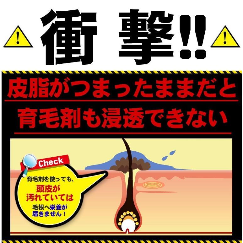沸騰ブラドン 頭皮マッサージ しっかり洗いたい方 シャンプーブラシ 毛穴汚れ シャンプーブラシ Japan In Made 国産 日本製 メンズ 効果 頭皮 お風呂用 馬毛 スカルプブラシ セット 黒馬毛 さくら 正規品 浅草アートブラシ レディースヘアケア Zenan Ca