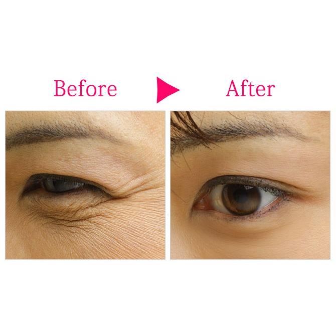 ほうれい線 リフトアップ シワ 小顔 たるみ ヘアーバンド ヘアバンド ヒルナンデス 瞬間リフトアップ メール便対応 おしゃれ ココチのくらし雑貨店 通販 Yahoo ショッピング