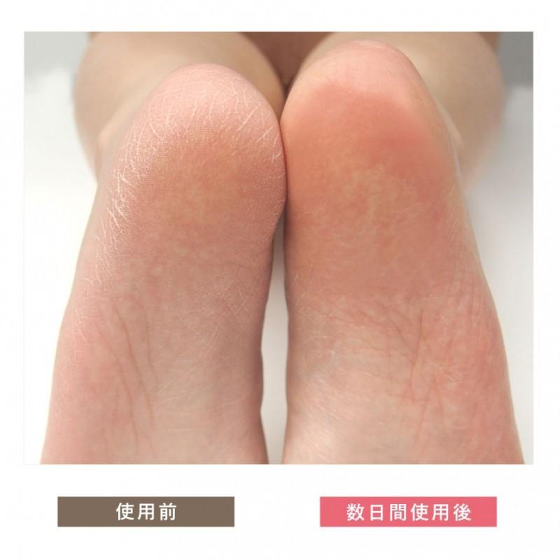 かかとつるつる 靴下 かかとケア シルク ソックス かかと 保湿 サポーター 薄手 薄い ナイトケア 夜 睡眠時 就寝時 就寝用 寝る時 乾燥対策 乾燥 おやすみ お休 ココチのくらし雑貨店 通販 Yahoo ショッピング