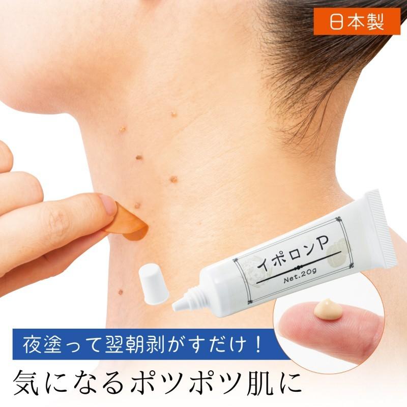 イボ いぼ 除去 イボ取り いぼ取り クリーム 首 顔 パック イボケア 美容成分 ヒアルロン酸 コラーゲン スクワラン 美肌 フェイス 肌 スキンケア 化粧品 ケア ア ココチのくらし雑貨店 通販 Yahoo ショッピング