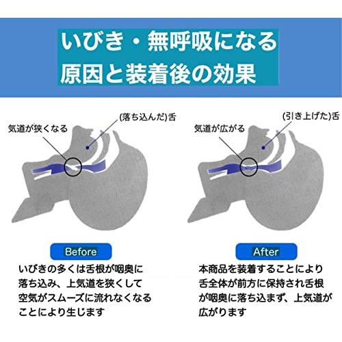 Trust Contact 舌用マウスピース 鼻呼吸 いびき防止 グッズ 睡眠 いびき 取扱説明書 舌 マウスピース｜earth-c｜03