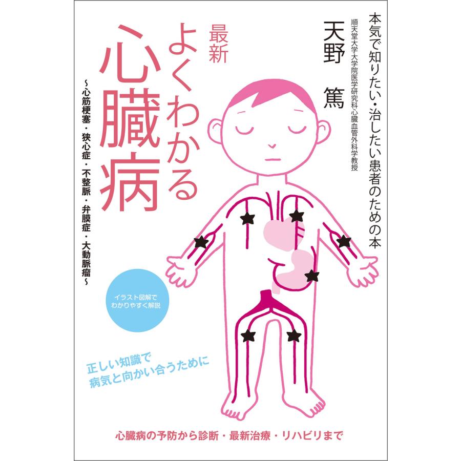 最新 よくわかる心臓病 心筋梗塞 狭心症 不整脈 弁膜症 大動脈瘤 電子書籍版 天野篤 B Ebookjapan 通販 Yahoo ショッピング