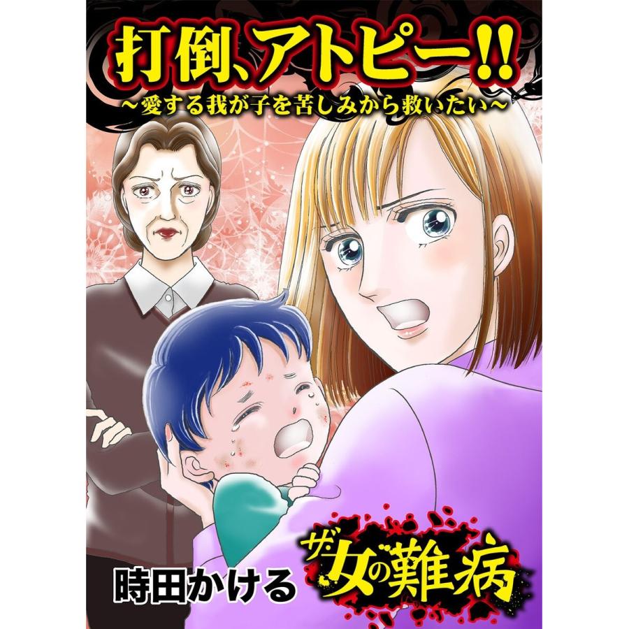 ザ 女の難病 打倒 アトピー 愛する我が子を苦しみから救いたい 私の人生を変えた女の難病vol 1 電子書籍版 時田かける B Ebookjapan 通販 Yahoo ショッピング