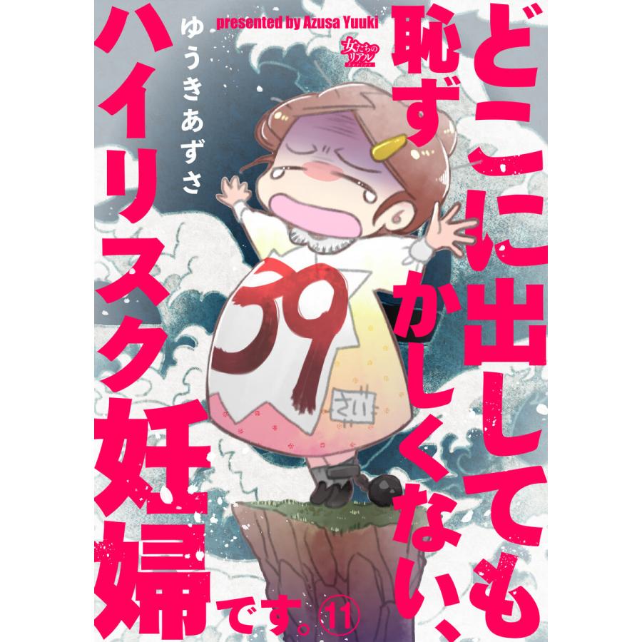 どこに出しても恥ずかしくない、ハイリスク妊婦です。【第11話】 電子書籍版 / ゆうきあずさ｜ebookjapan