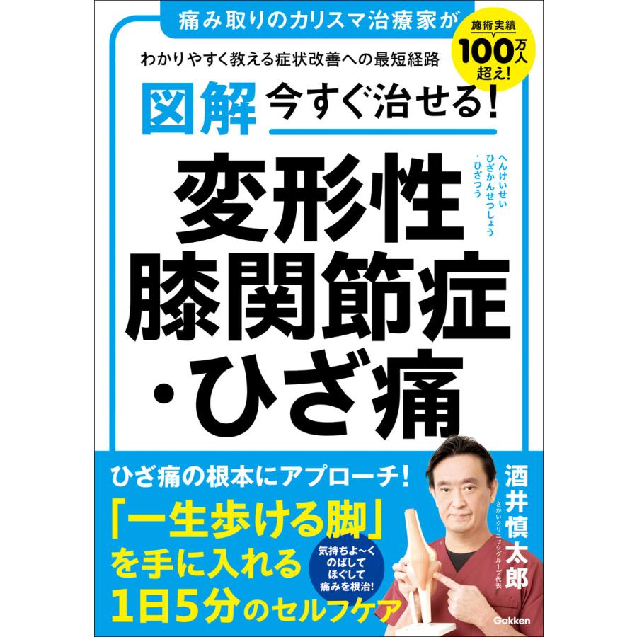 図解 今すぐ治せる! 変形性膝関節症・ひざ痛 電子書籍版 / 酒井慎太郎(著) | 