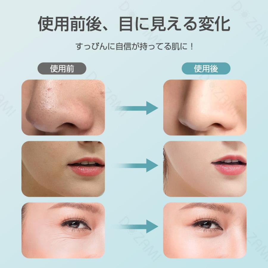 母の日2025人気ギフト】超音波美顔器 1台多役 フェイスケア 目元 母の日2025人気ギフト】超音波美顔器 1台多役 フェイスケア 目元