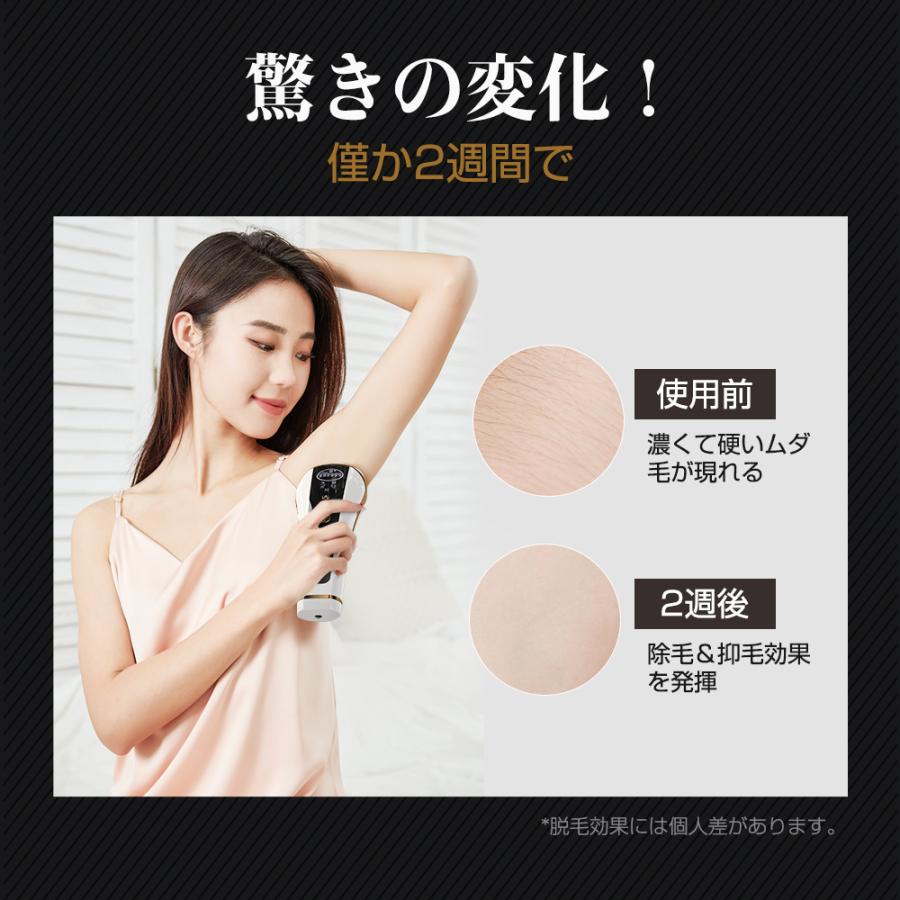 Hokonui 【新モデル・先着限定クーポン5980円】脱毛器 VIO対応 99万回
