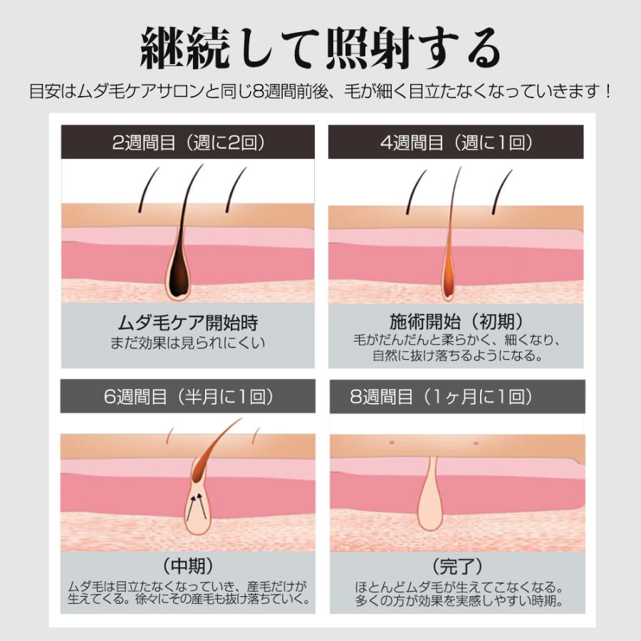 Hokonui 【新モデル・先着限定クーポン5980円】脱毛器 VIO対応 99万回