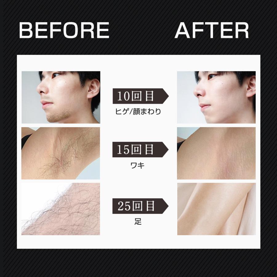 【限定販売】脱毛器 男女兼用 美容 フェイシャル 全身対応 高品質 Hokonui 【新モデル・先着限定クーポン5980円】脱毛器 VIO対応 99万回