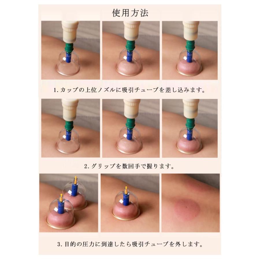 真空ポンプ セット ハンドポンプ1個＋吸い玉カップ12個 吸玉 吸い玉