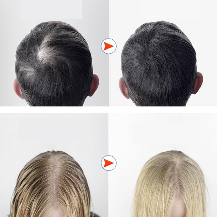 〜育毛ヘルメット（ヘアスタイル）※値下げ交渉有 LED 育毛キャップ 赤色 led 育毛 頭皮ケア ヘアケア 育毛システム120個