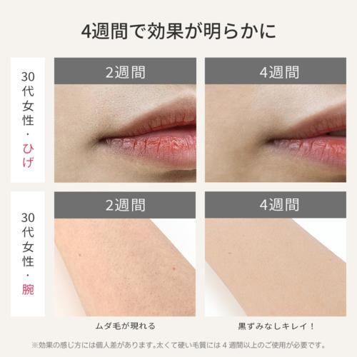 Ulike(ユーライク) UI06S 光美容器 ULIKE AIR3トータルケアセット