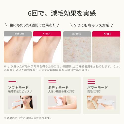 長期保証付】Ulike(ユーライク) UI06S 光美容器 ULIKE AIR3トータル