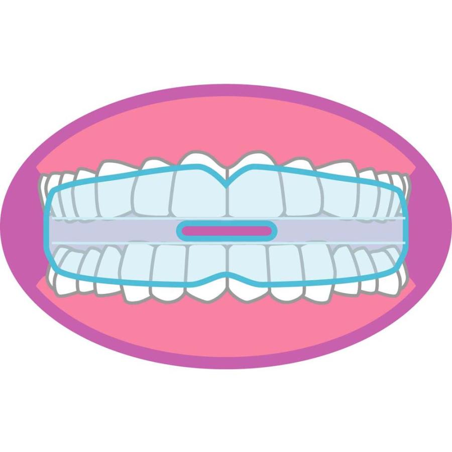 東京企画販売 いびきマウスガード TKSM-018 | ブランド登録なし | 04