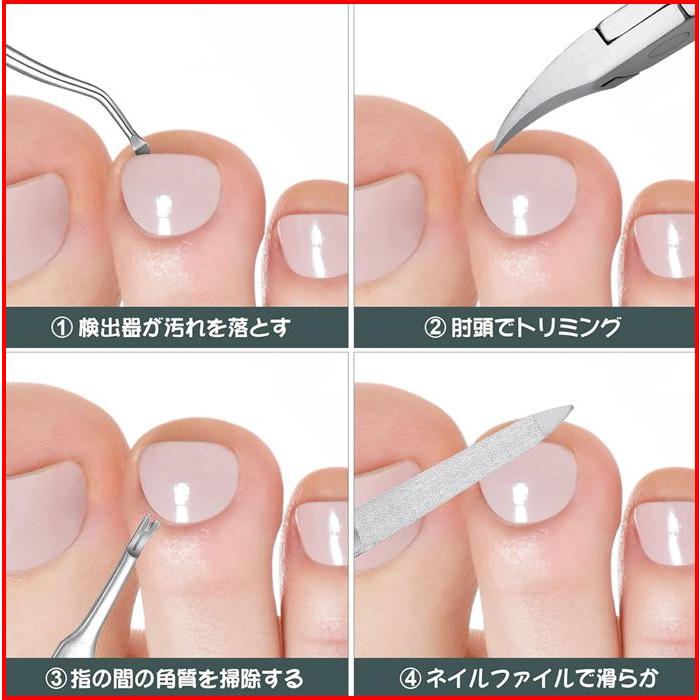 最終処分品 爪切ニッパー 爪切りセット 巻き爪 硬い爪 つめきり ネイルケア 爪やすり 子ども よく切れる  硬い 爪 6点セット 爪やすり ゾンデ | ブランド登録なし | 09