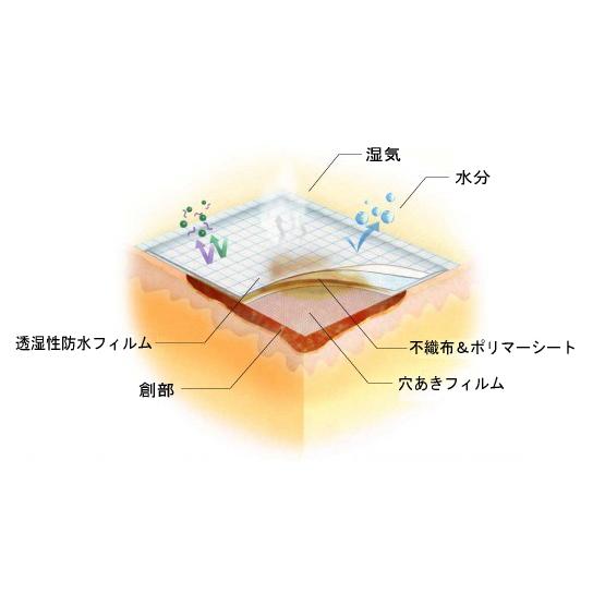 白十字 （2箱セット）モイスキンパッド7520／30袋入×2箱（白十字）滅菌